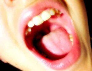 mouth
